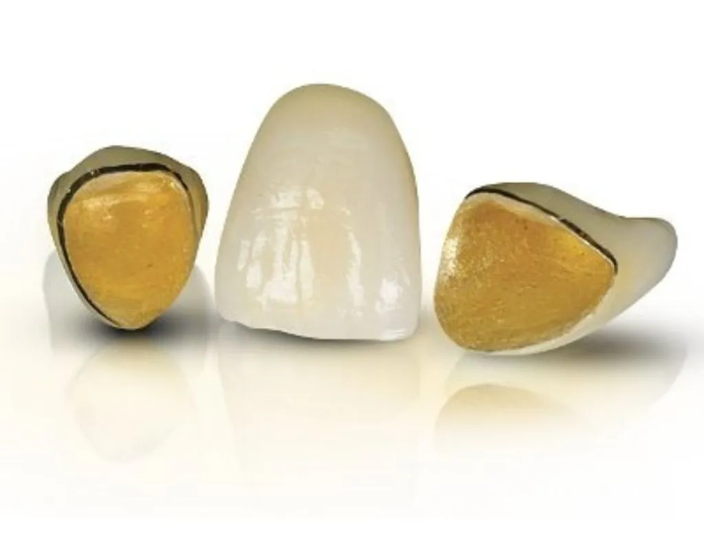 Captek Dental Crowns Dental Office Network
