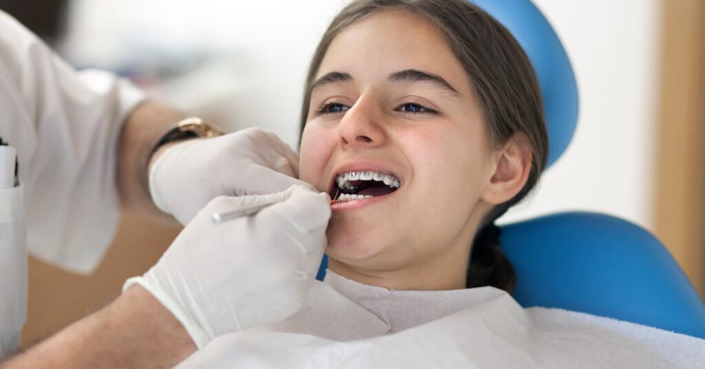 Dental Braces