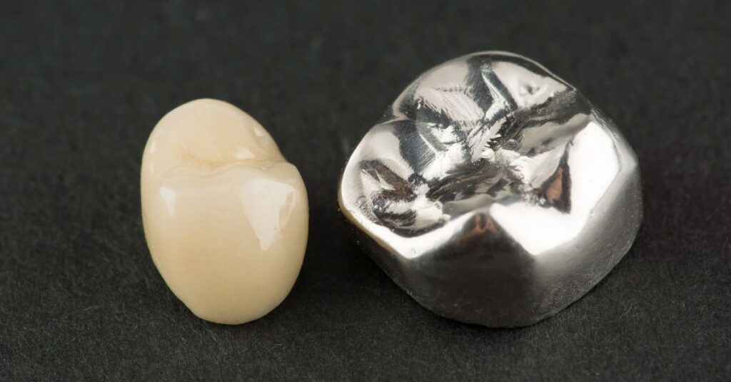 Dental Crowns