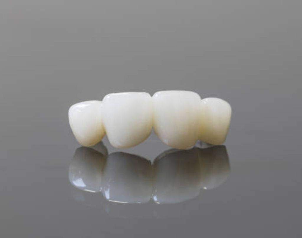 Zirconia Dental Crowns Dental Office Network #dentistry #crown