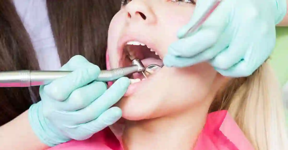 Demystifying Dental Tartar Understanding its Impact on Oral Health