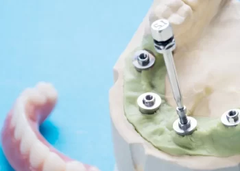 All on 4 Dental Implants