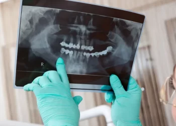 Benefits of the All-on-4 Dental Implant Procedure.