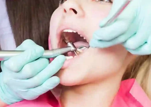 Demystifying Dental Tartar Understanding its Impact on Oral Health