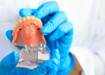 What Makes The All On 4 Dental Implant Procedure Different?